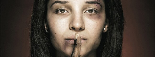 A photo of a Brown woman with bruises on her face making a shush sign with her hand.