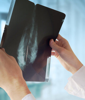 A photo of a medical professional looking at a mammogram