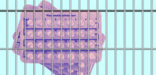 A collage of birth control pills before bars.
