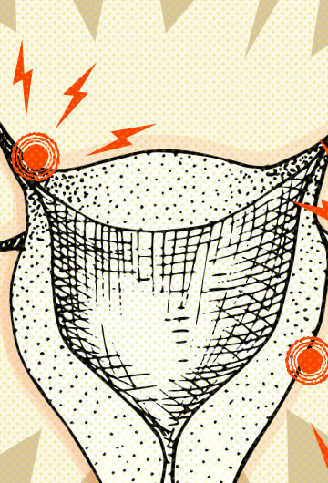 A collage of an illustration of a uterus with red lightning bolts signaling pain