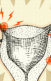 A collage of an illustration of a uterus with red lightning bolts signaling pain