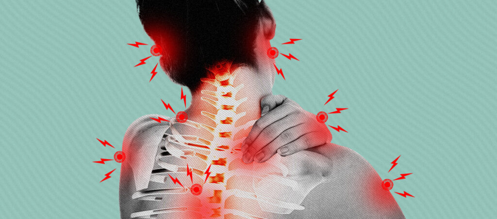 View of a woman from the back. Across her head, shoulder and back, there are red bolts indicating painful spots.