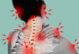 View of a woman from the back. Across her head, shoulder and back, there are red bolts indicating painful spots.